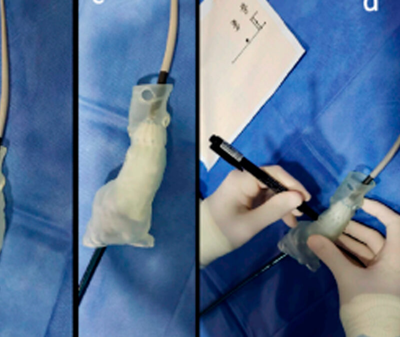 Nuevas tecnologías de imágenes para el diagnóstico y tratamientode los aneurismas de aorta complejos